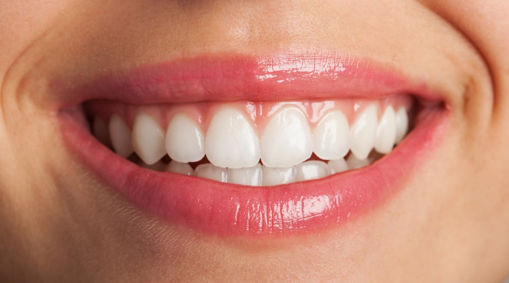 After Whitening