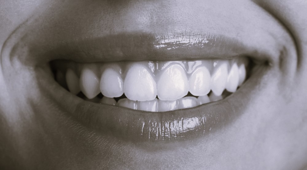 Before Whitening